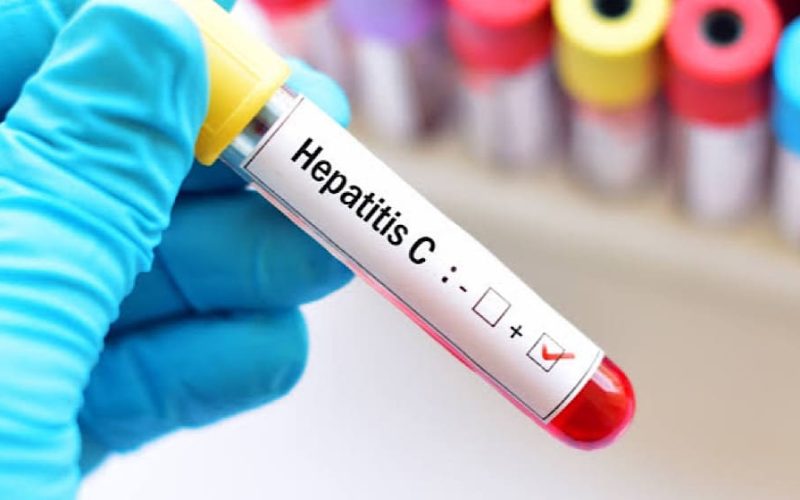 Nationwide Hepatitis C Screening Drive Delayed