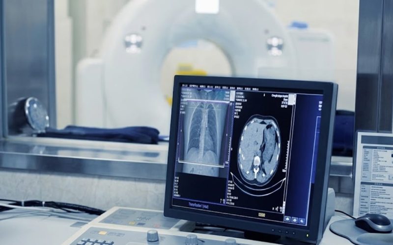 All Punjab Districts to Get New CT Scan Machines