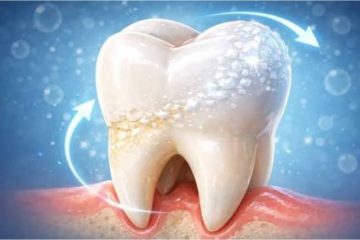 Scientists Develop Gel That Can Regrow Tooth Enamel